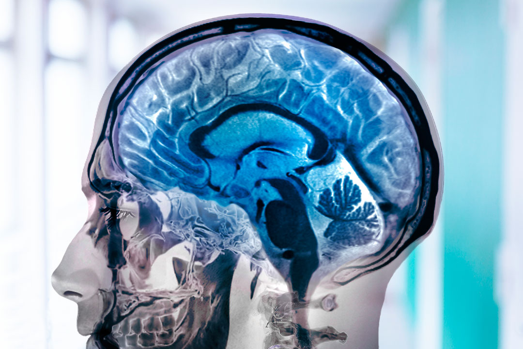 La diferencia entre la neurología y la psiquiatría