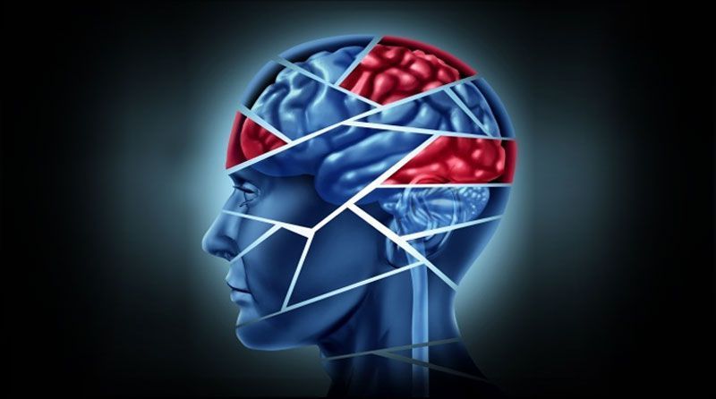 La rehabilitación de los Accidentes Cerebrovasculares