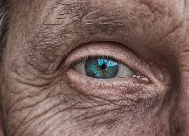 Las cinco A’s de Alzheimer